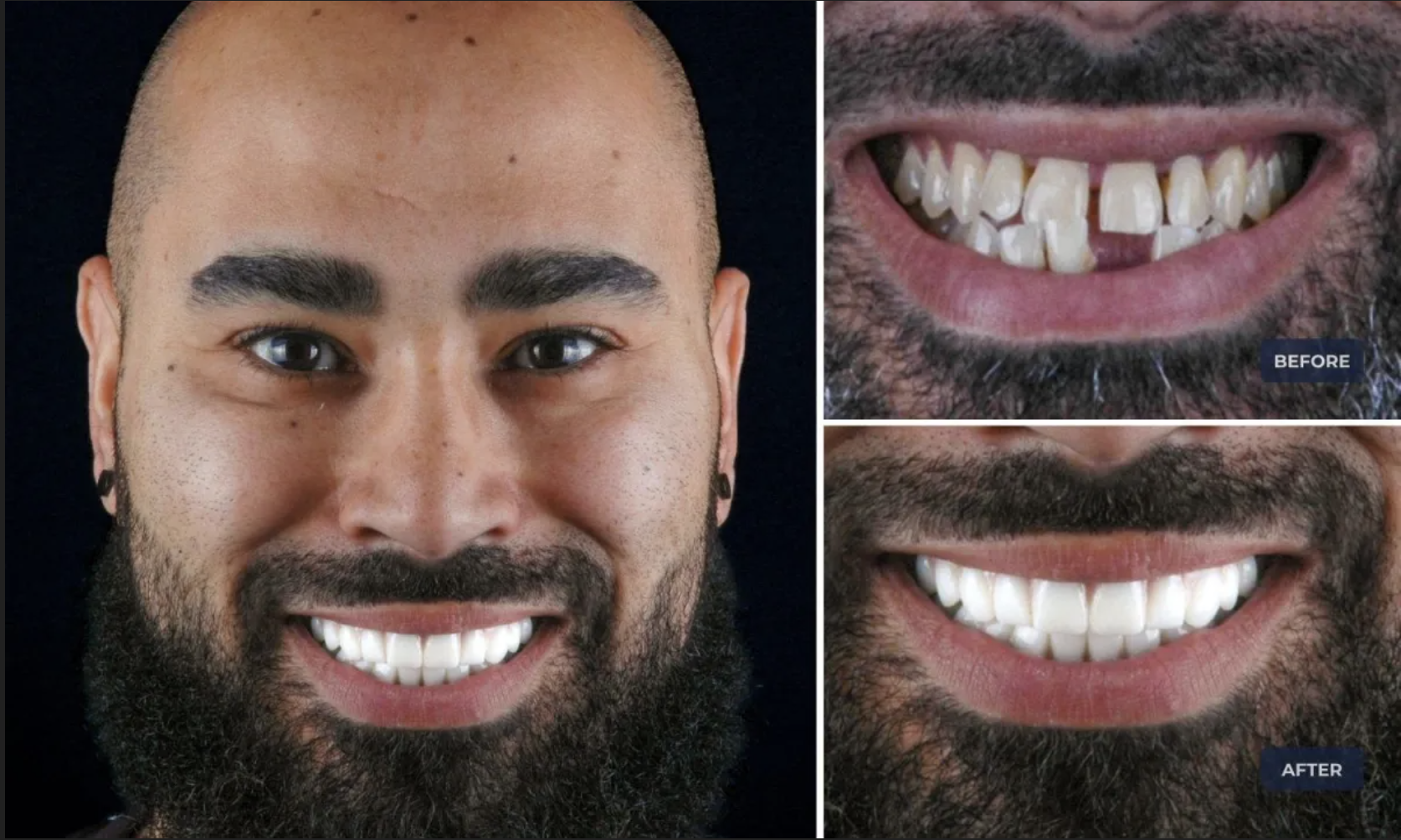 before-after